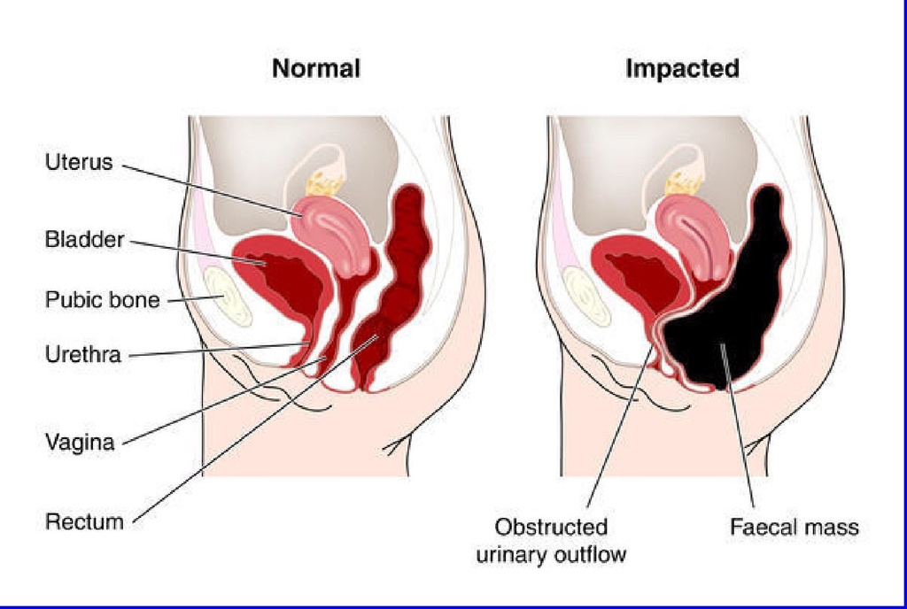the-one-minute-miracle-oxy-colon-cleanse-6.jpg