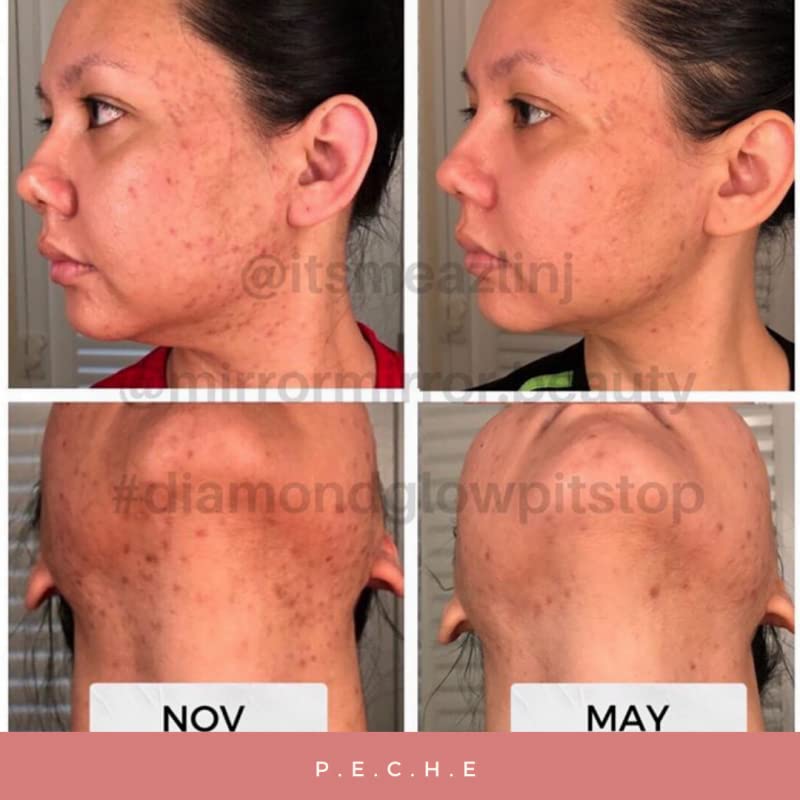 diamond-glow-skin-supplement-for-whiteni-2.jpg