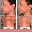 diamond-glow-skin-supplement-for-whiteni-2.jpg
