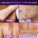 cicatricure-advanced-scar-gel-for-face-b-4.jpg