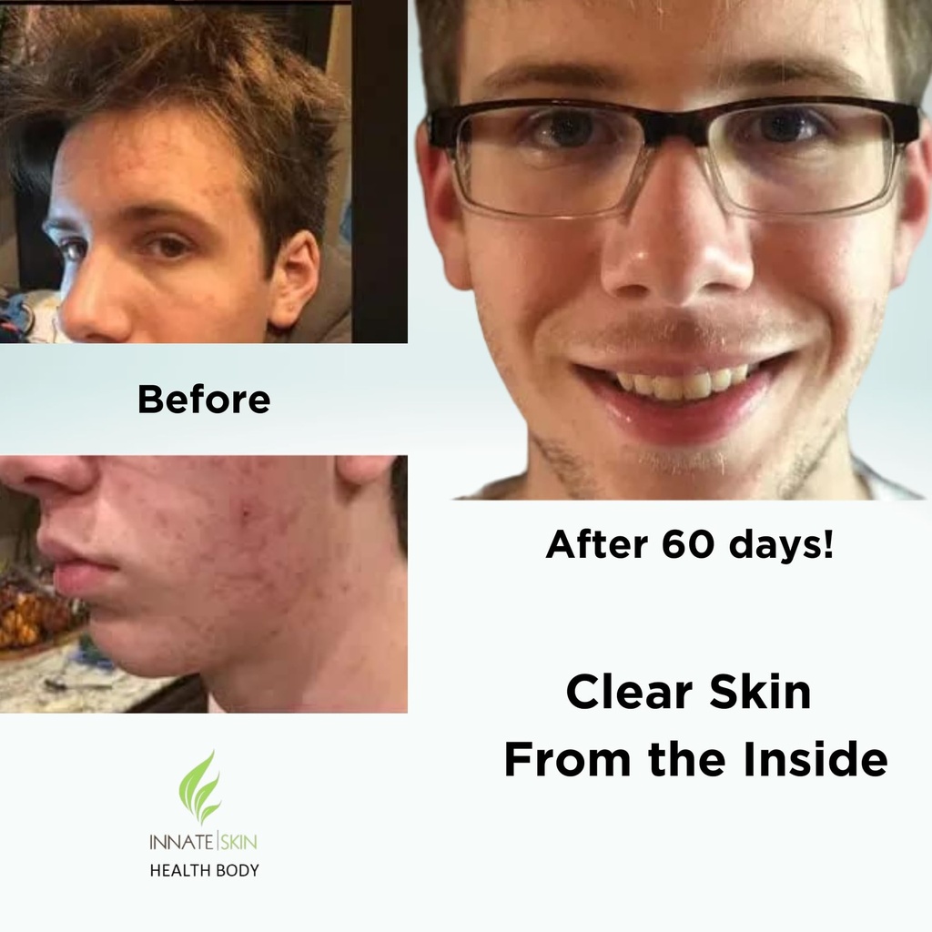clear-skin-acne-vitamin-system-20-antiox-4.jpg