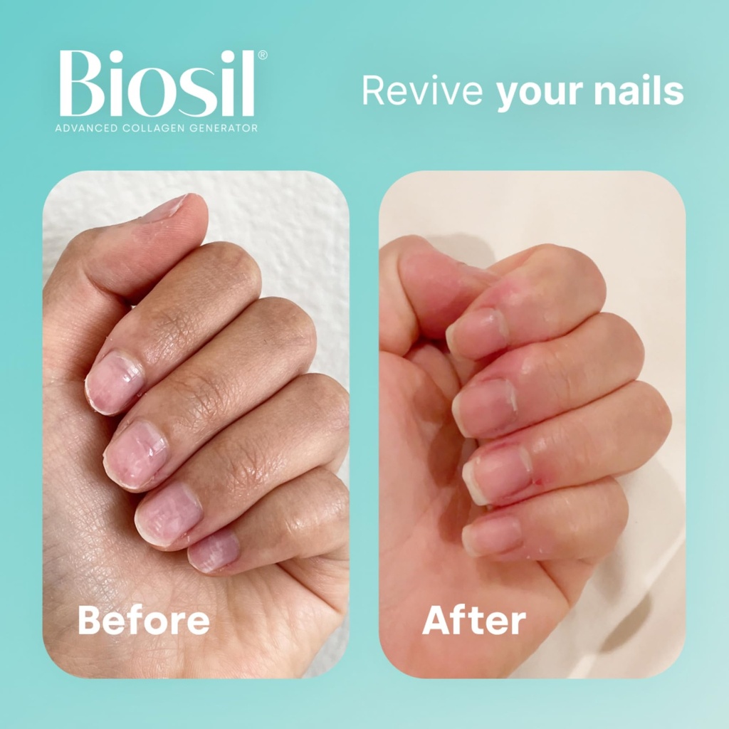 biosil-capsules-collagen-generator-veggi-6.jpg