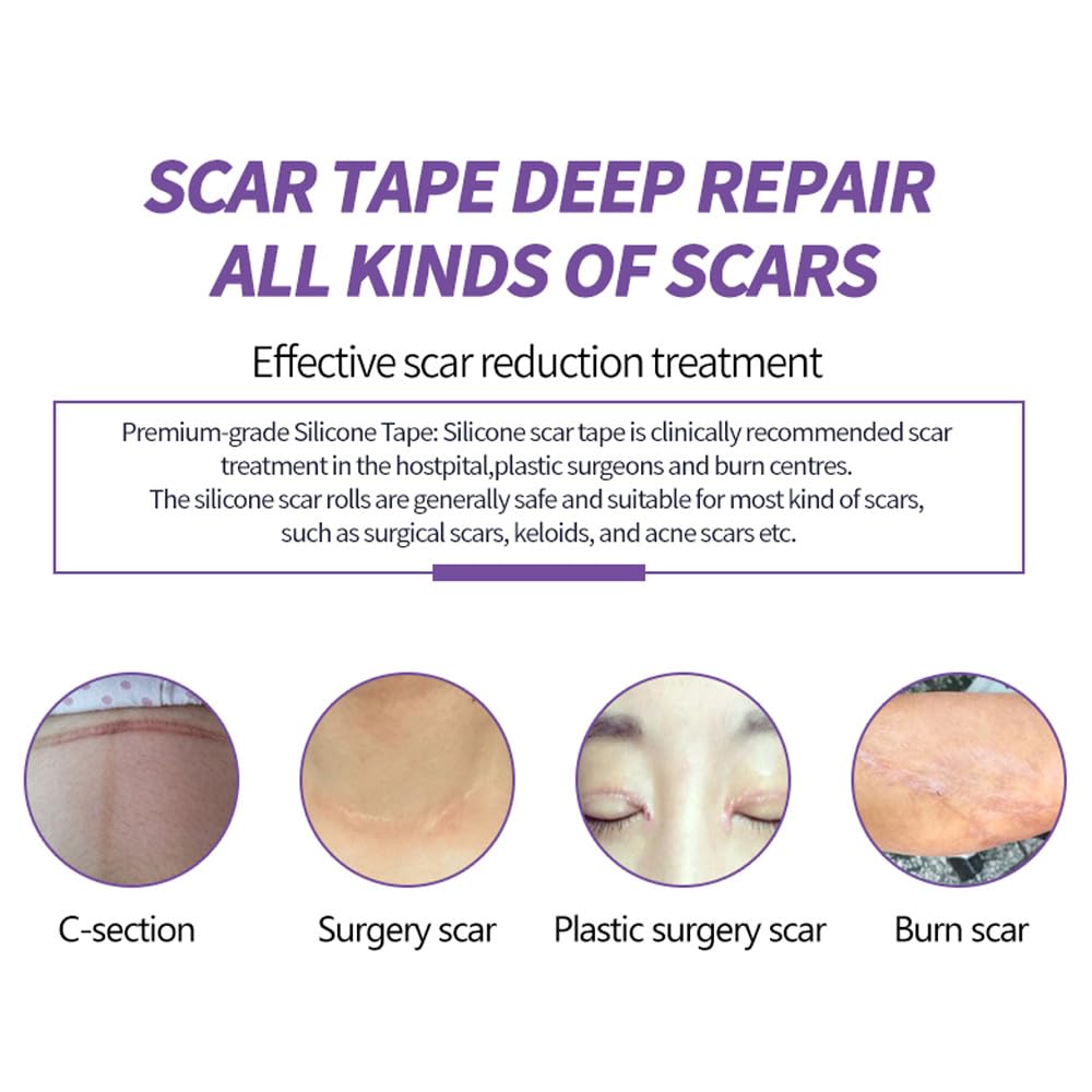 hpufkot-medical-grade-silicone-scar-shee-6.jpg