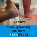 ankle-sprain-recovery-patches-helps-spee-6.jpg