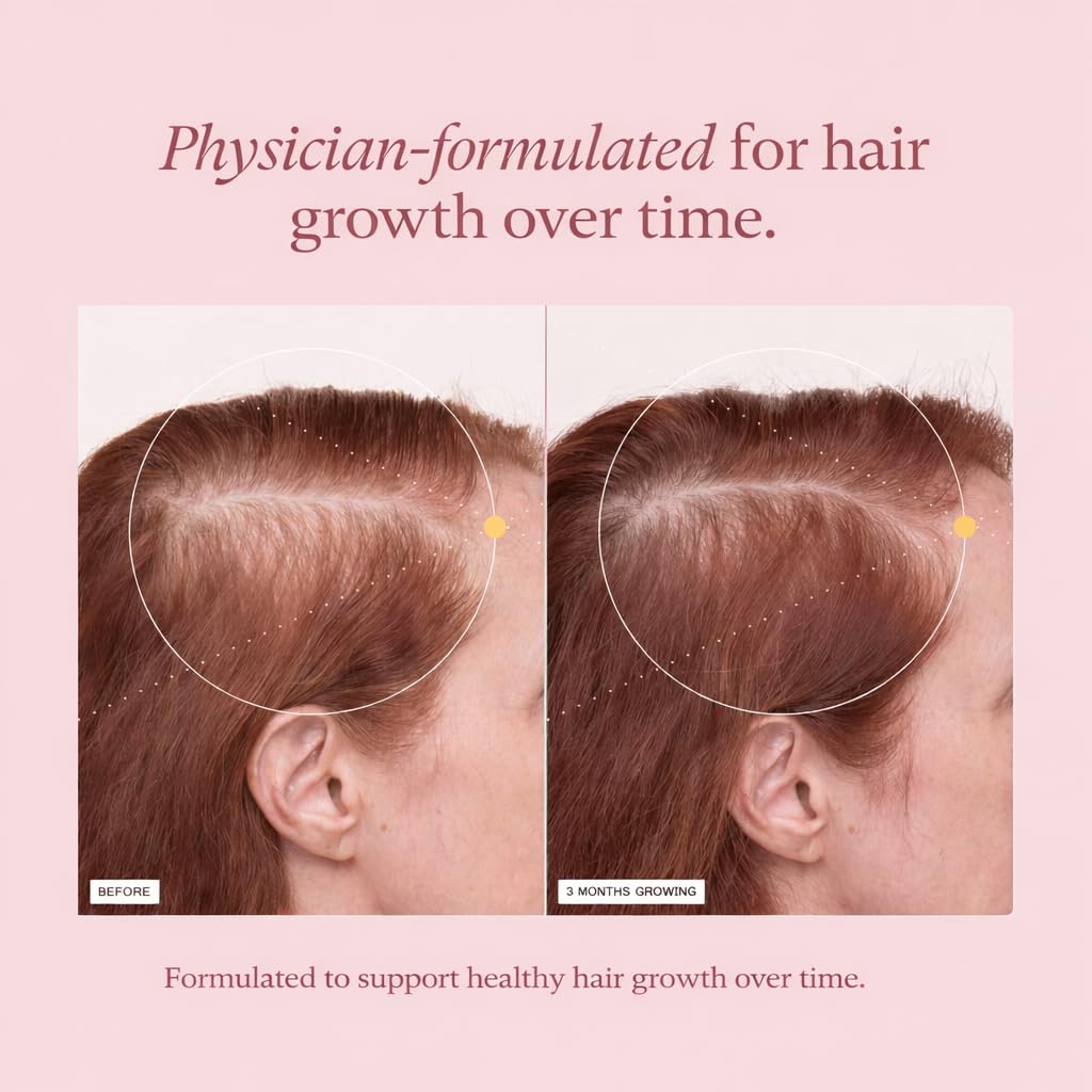 ashwagandha-for-women-with-biotin-collag-3.jpg
