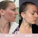 revive-collagen-premium-hydrolyzed-marin-5.jpg