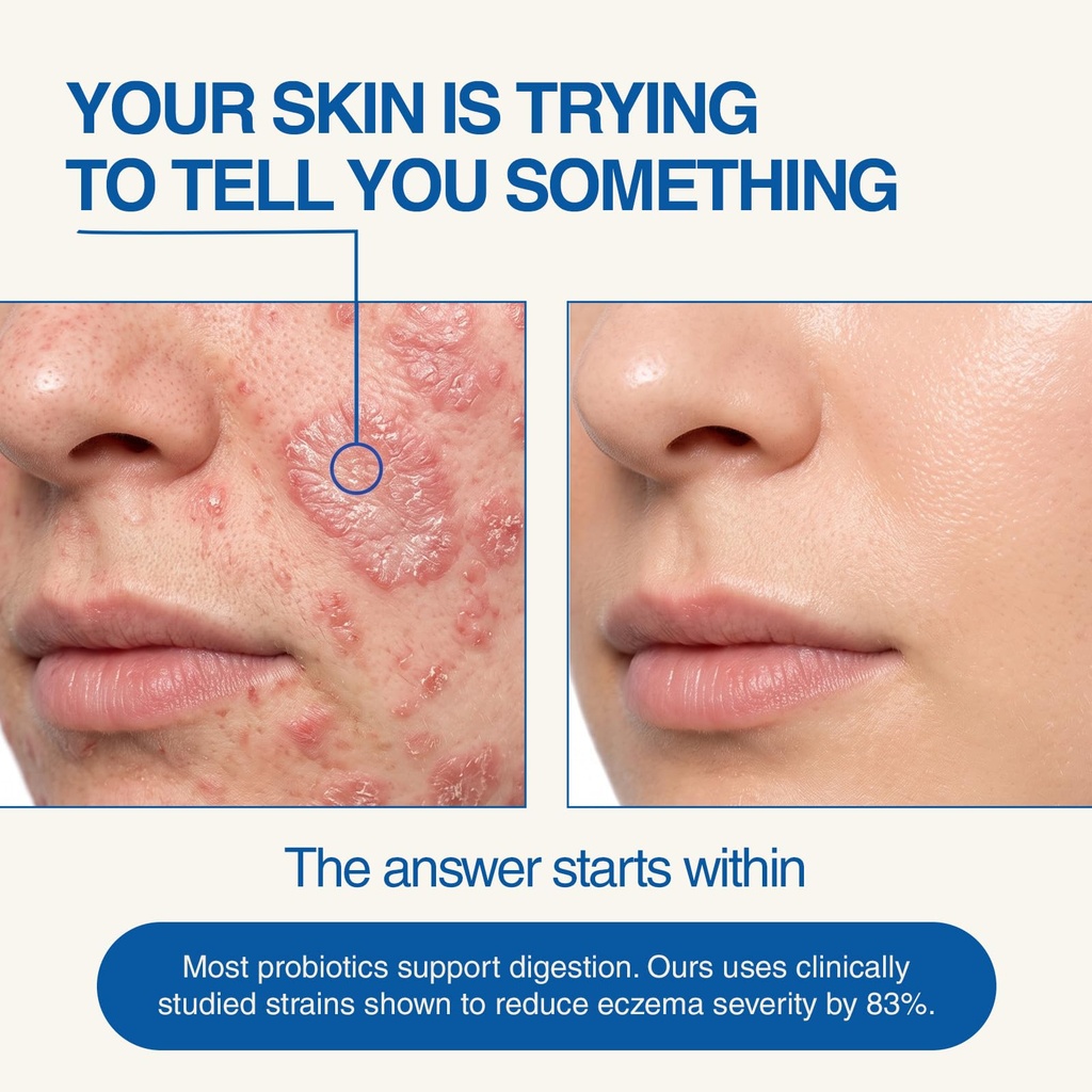 borniu-skin-renew-probiotics-for-women-m-3.jpg