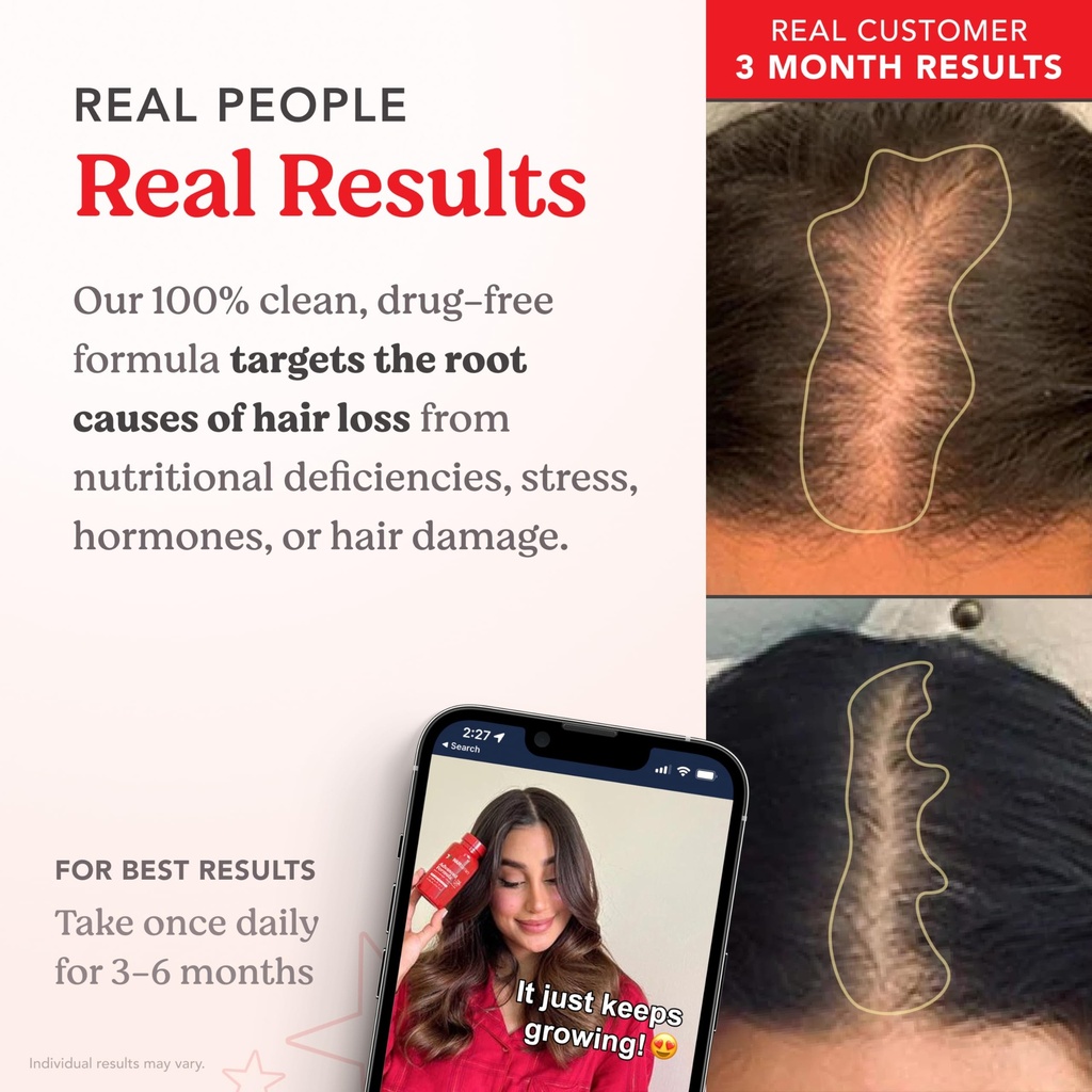 hairtamin-advanced-formula-hair-growth-s-4.jpg