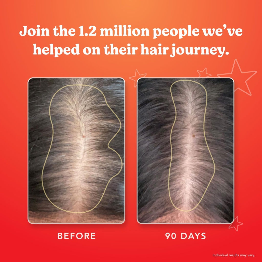 hairtamin-advanced-formula-hair-growth-s-6.jpg