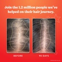 hairtamin-advanced-formula-hair-growth-s-6.jpg