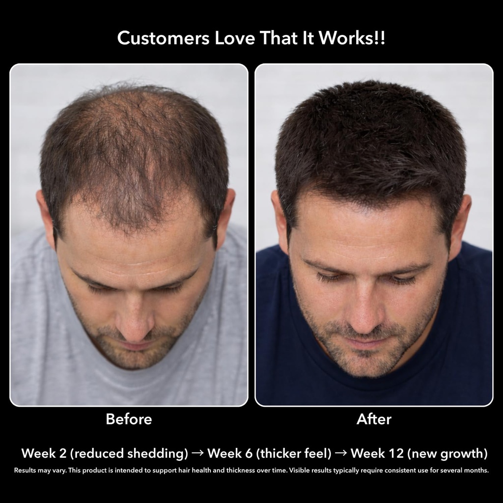 dht-blocker-for-men-with-biotin-10000mcg-5.jpg
