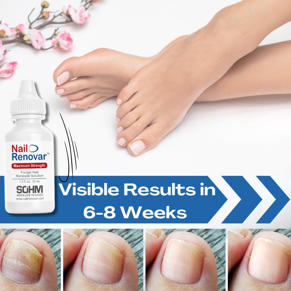 toenail-fungus-treatment-extra-strength--6.jpg