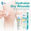 globe-3-oz-tube-hydrogel-first-aid-wound-5.jpg