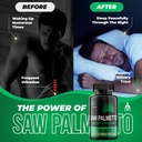saw-palmetto-for-men---prostate-health-s-4.jpg