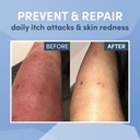 ad-rescuewear-ultra-soft-non-itch-eczema-5.jpg
