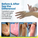 dermasolve-full-body-eczema-relief-lotio-3.jpg