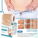 silicone-scar-sheets-silicone-scar-tape1-4.jpg