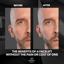 beverly-hills-mens-instant-facelift-and--5.jpg
