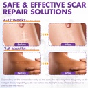 silicone-scar-sheets-silicone-scar-tape1-5.jpg