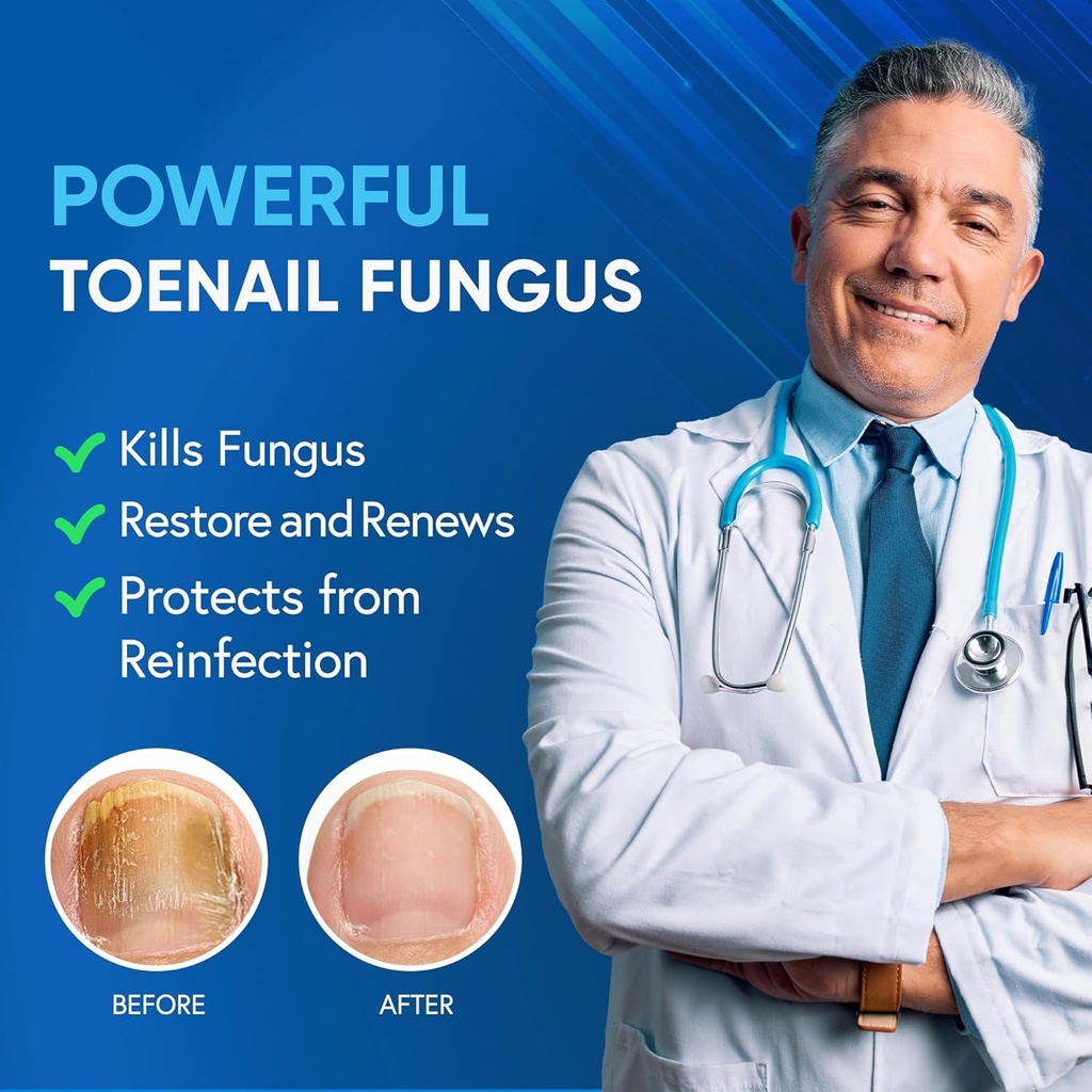 toenail-fungus-treatment-extra-strength--2.jpg