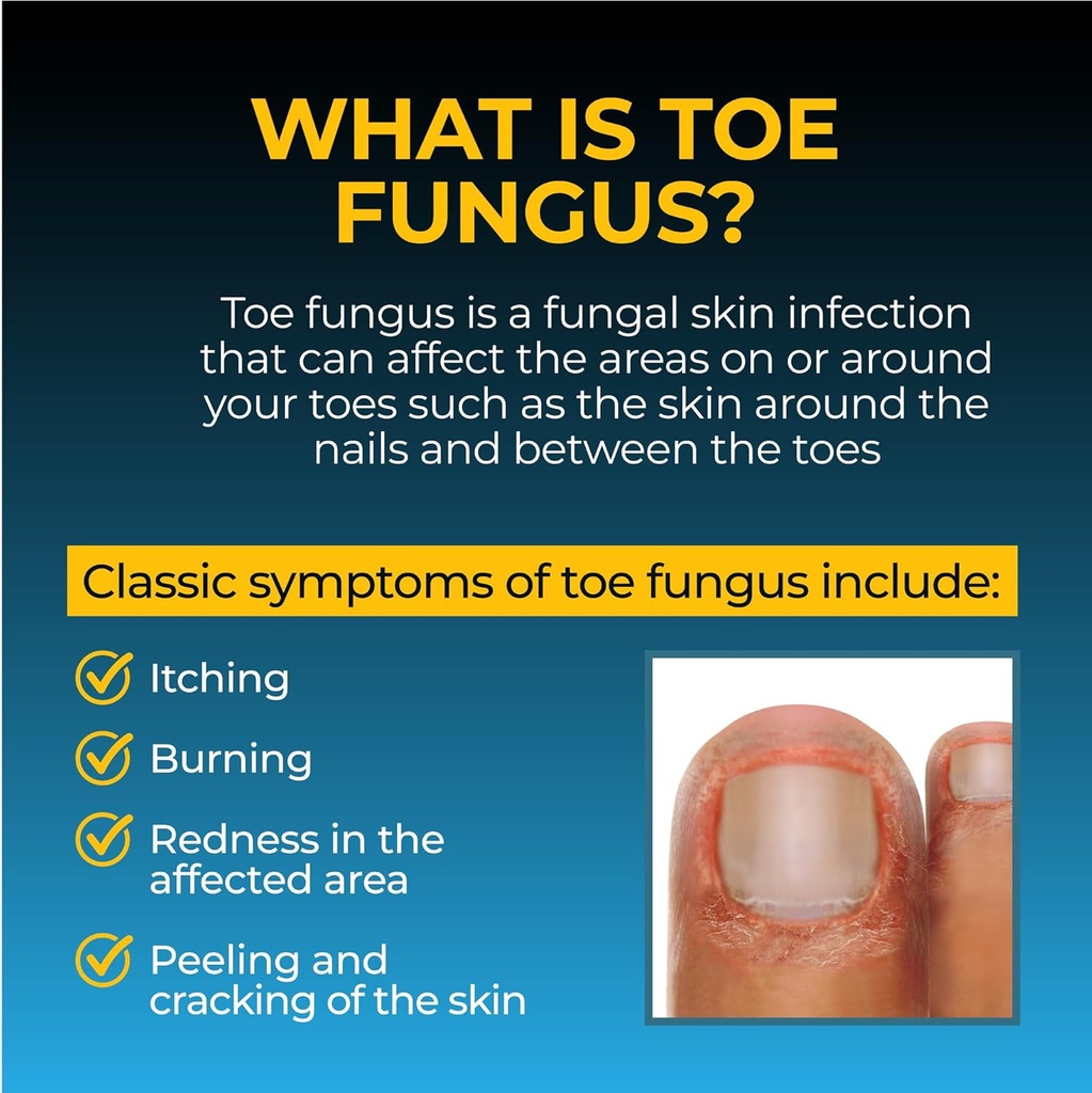 fungi-nail-anti-fungal-liquid-solution-k-4.jpg