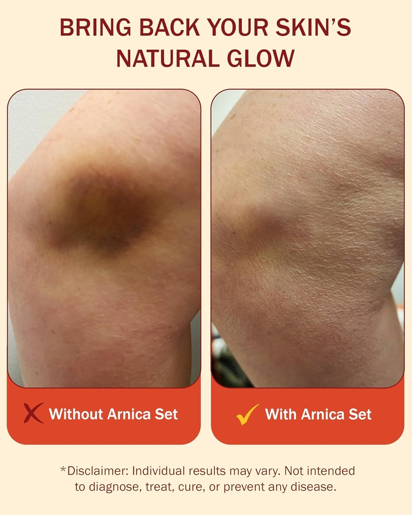 arnica-cream-arnica-gel-roll-on-2pk-for--5.jpg
