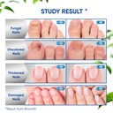 toenail-fungus-treatment-extra-strength--4.jpg
