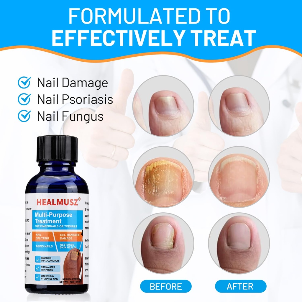 toenail-fungus-treatmenttoe-fungus-nail--3.jpg