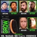 beard-growth-kit-wgrow-xxl-beard-oilseru-5.jpg