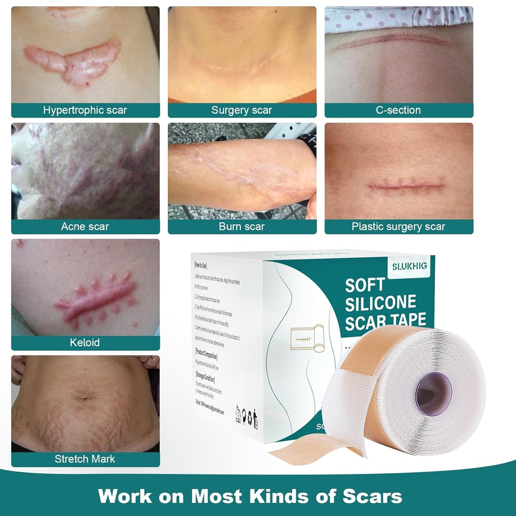 silicone-scar-sheets-16x-158-roll-4m-sil-2.jpg
