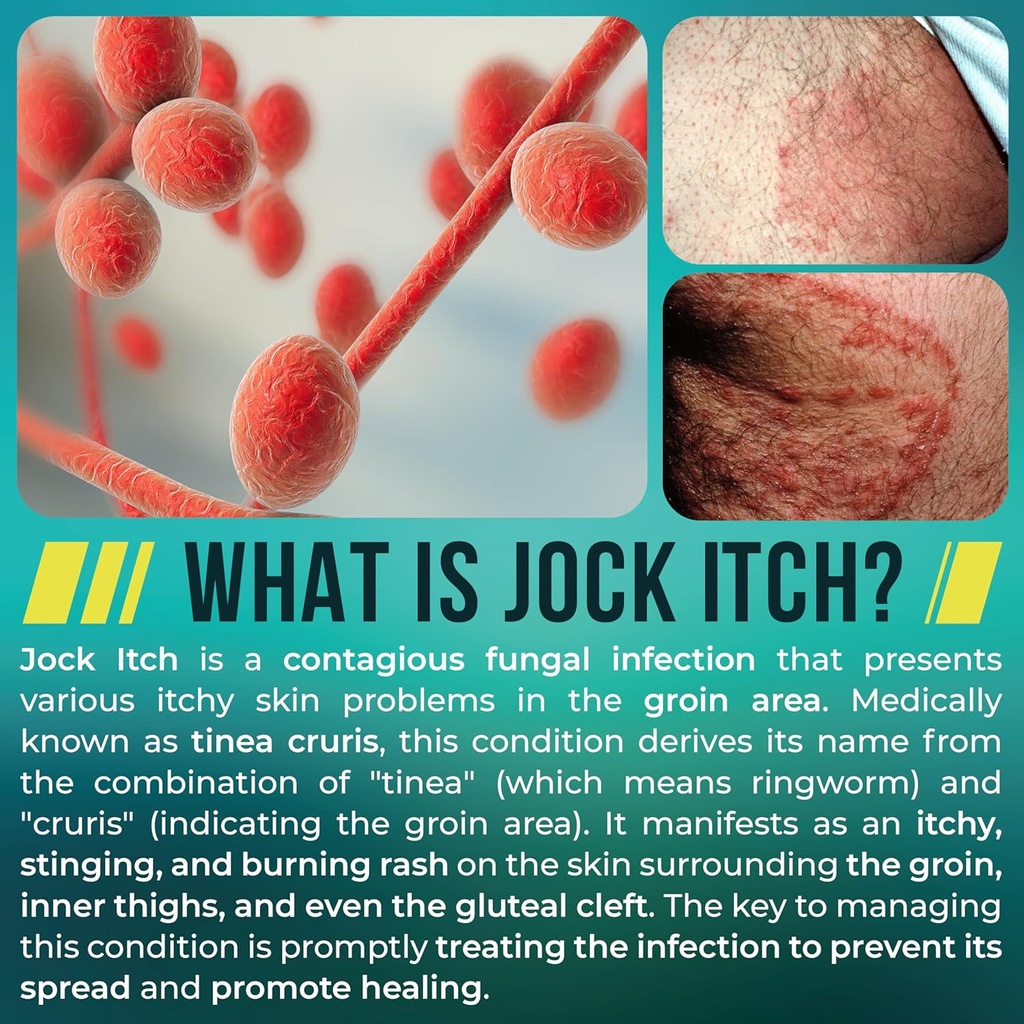 jock-itch-spray-antifungal-spray-for-joc-5.jpg