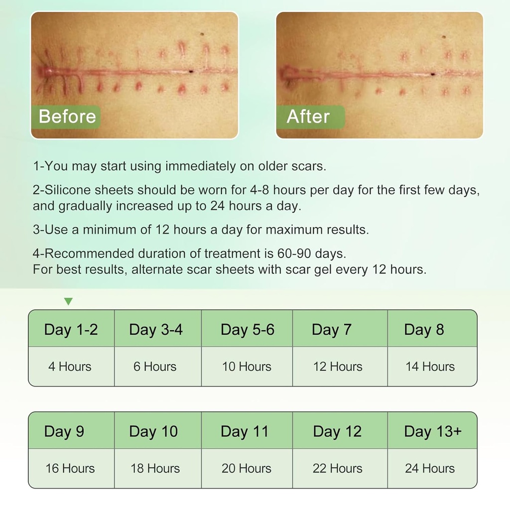 silicone-scar-sheets-clear-silicon-gel-s-5.jpg
