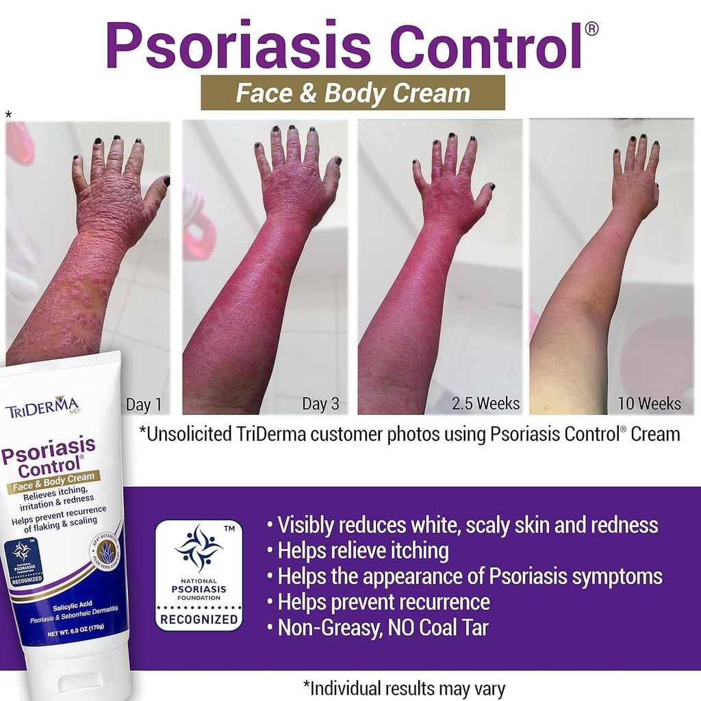 triderma-psoriasis-control-face-body-cre-2.jpg