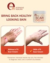scar-cream-gel-for-surgical-scars-fast-r-5.jpg