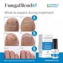 fungablend-10---antifungal-medication1-t-3.jpg