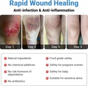lmnoop-wound-healing-ointment-for-chroni-6.jpg