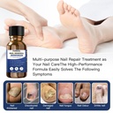 toenail-fungus-treatmentfoot-fungus-trea-4.jpg