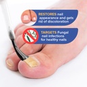 toenail-fungus-treatment-extra-strength--3.jpg