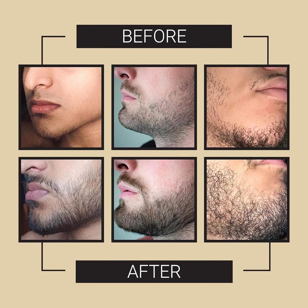 crafted-beards-beard-growth-oil-serum----2.jpg