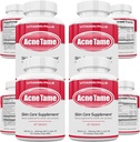 Acne Pills Supplement- Clear Skin Vitamins Pill for Oily Skin Treatment, Hormonal Blemishes, Anti Spots & Cystic Acnes Supplements for Women, Men, Teens & Adults- 240 Oral Tablets 2
