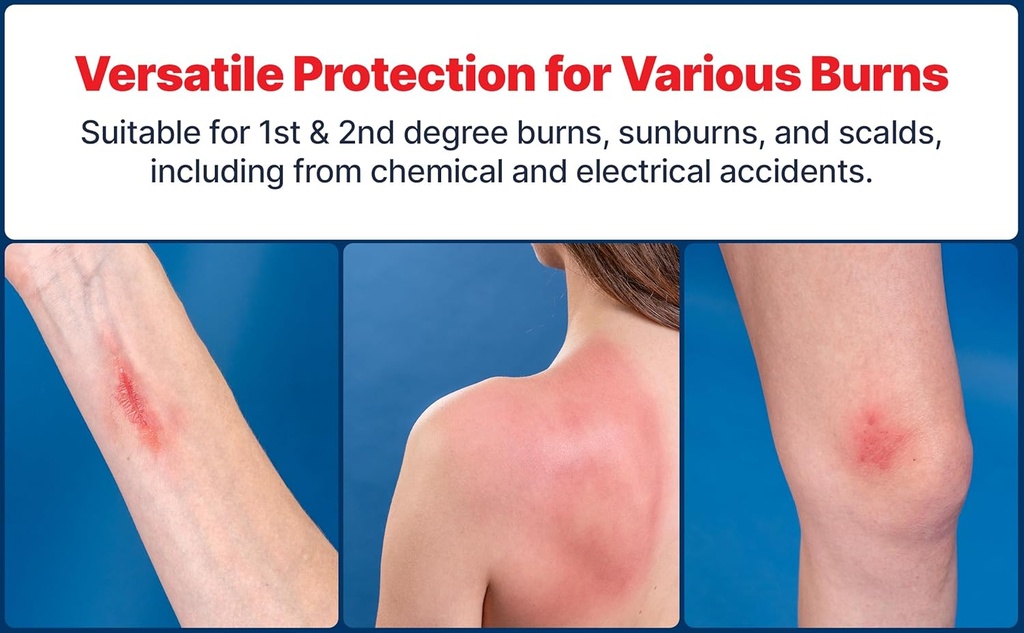 BurnFix® Hydrogel Burn Spray – 120 ml Instant Cooling Relief for 1st & 2nd Degree Burns, Sunburns & Scalds | Doctor-Recommended Moisturizing First Aid Essential for Kids & Adults 5
