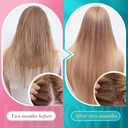 Biotin Gummies -Hair Skin and Nails Vitamins for Men & Women, Vegan Vitamin B7, Supports Hair Growth and Stronger Nails,60 Day Supply-Raspberry-2 Pack 5