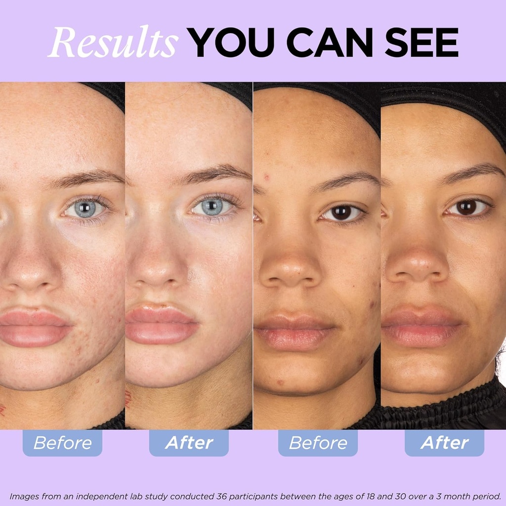 ZitSticka Vitamin Acne Supplement for Cystic Acne w/ 30 Natural Caps for Women and Men, Supplements for Hormonal Support, Skin Clarity, Dark Spots - Dermatologist Tested (After Hours Ceramides) 5