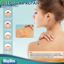professional-silicone-scar-sheets-1-6-x--4.jpg