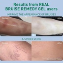 procure-arnica-msm-bruise-remedy-gel-par-5.jpg