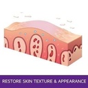 prosoria-psoriasis-exfoliating-moisturiz-4.jpg
