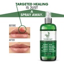 thyme-out-all-natural-eczema-treatment-p-5.jpg