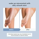 magnesium-oil-spray-for-sore-muscles-fee-6.jpg
