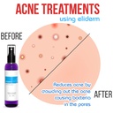 topical-probiotic-spray-for-skin-13-stra-4.jpg