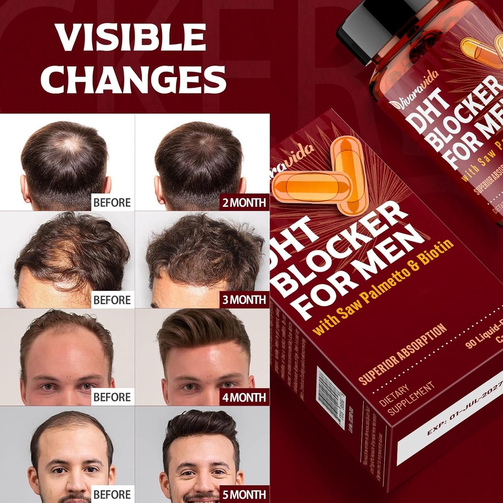 dht-blocker-for-men-hair-growth-suppleme-6.jpg